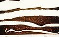tapeworm common in foxes, skunks, dogs and raccoons (Taenia saginata ) Subtaxa:Cyclophyllidea