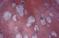 Thumbnail for version as of 05:00, 1 December 2010