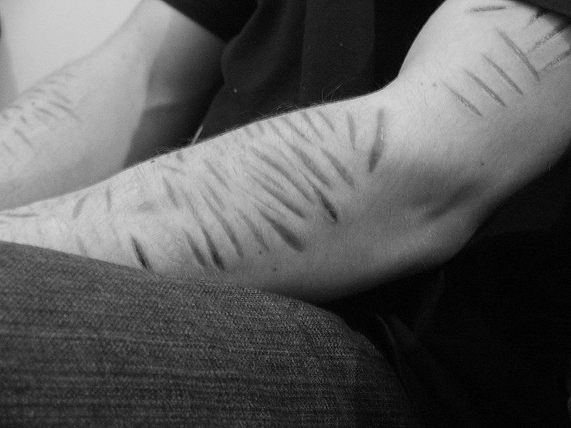 File:Scars from Cutting.jpg