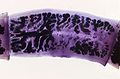 human tapeworm (Taenia solium) Subtaxa:Cyclophyllidea