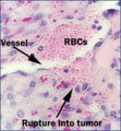 Thumbnail for version as of 04:48, 19 January 2008