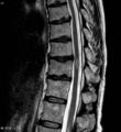 Thumbnail for version as of 05:23, 13 January 2015