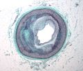 Thumbnail for version as of 19:18, 6 November 2016