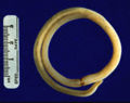 A human intestinal roundworm (Ascaris lumbricoides)