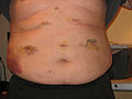 Thumbnail for version as of 23:34, 3 January 2010