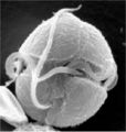 Dinoflagellate Phylum: Dinoflagellata