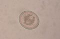 A canine roundworm egg. Photo taken through a microscope at 40x