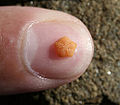 Thumbnail for version as of 01:24, 3 December 2009