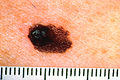Thumbnail for version as of 08:14, 3 January 2010