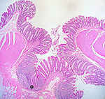 Ascending colon.jpg