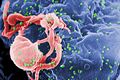 HIV-1 budding from cultured lymphocyte. Multiple round bumps on cell surface represent sites of assembly and budding of virions.