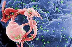 HIV-1 SEM.jpg