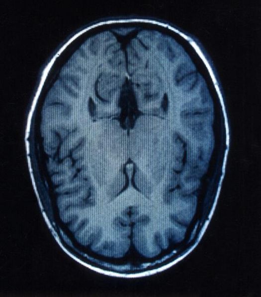 File:Brain MRI.jpg