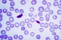 Plasmodium (Plasmodium falciparum)